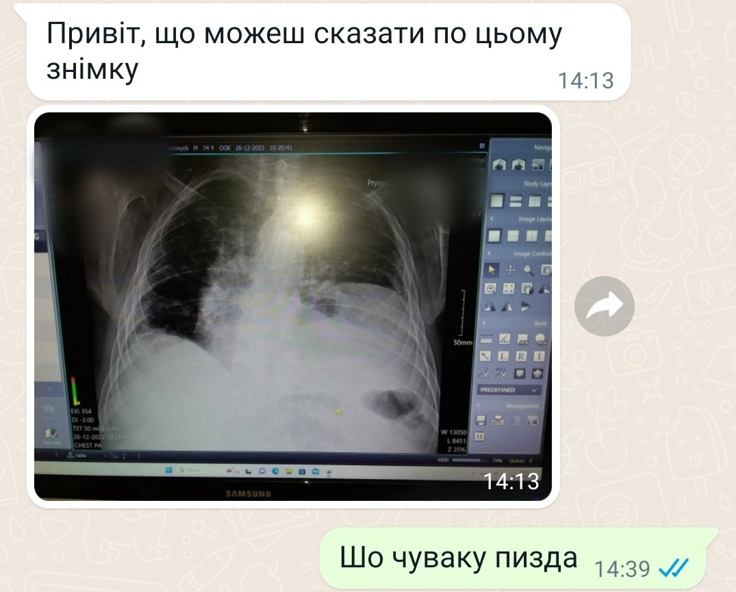 Veremiy_MD's tweet photo. То шо ж таки сталось? Ну дивіться, пише мені наш водій медпункта, який весь день возить наших немічних воїнів по лікарнях в якості медичного блять таксі. Скидає знімок.Я відповідаю як типовий армійський уїбень. Шо, по-вашому могло піти не так? https://t.co/r9xmyp2FJx