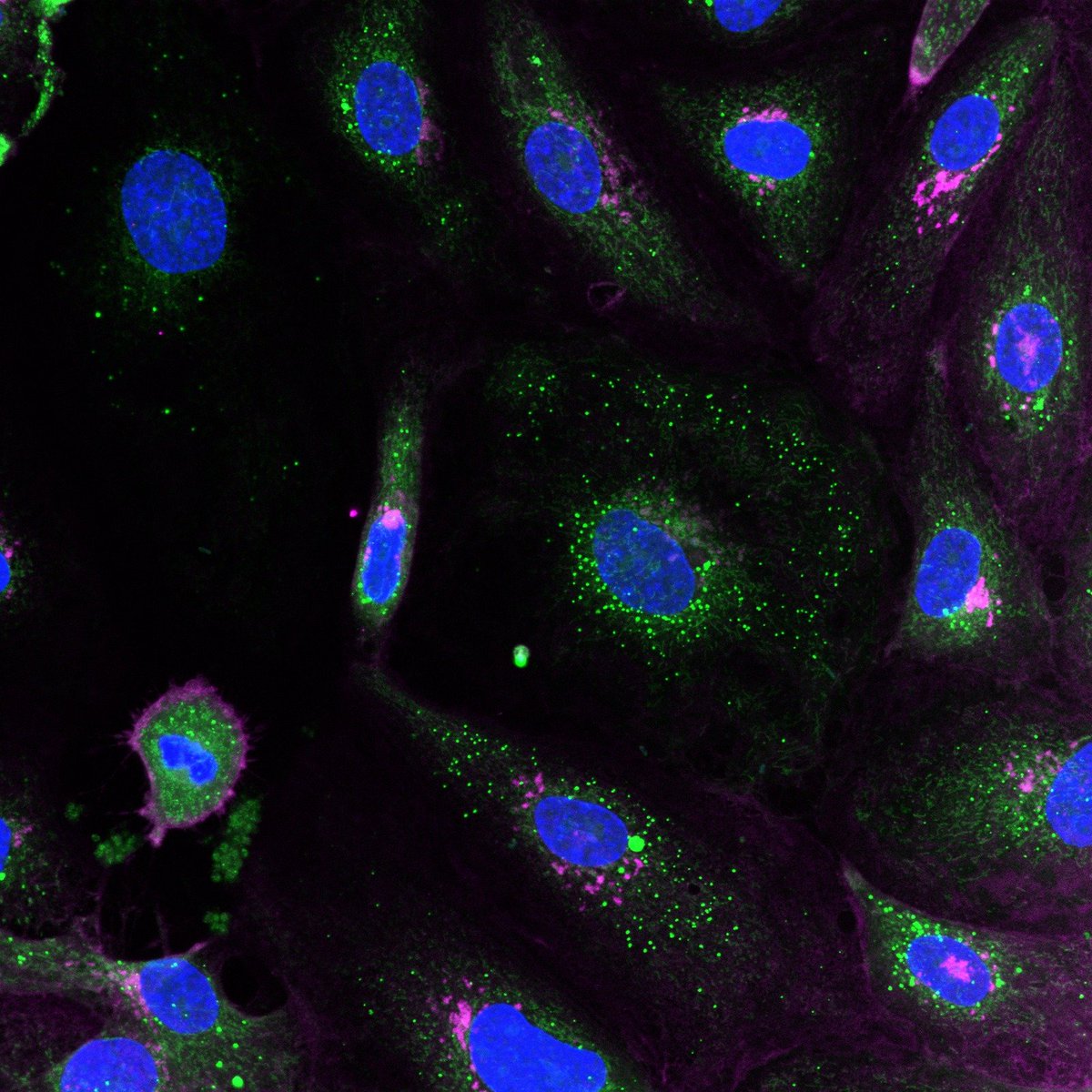MMU Thrombosis Research Group (@mmu_thrombosis) on Twitter photo We're back in the lab after our winter break, and we're already busy running 🔬 #experiments! 👩🔬🧑🔬
#Thrombosis #Microscopy
image credit: <a href="/marblanez/">María Blanco López</a>
<a href="/MMU_LifeScience/">ManMet Life Sciences</a> <a href="/MMUEngage/">Manchester Met Science and Engineering</a> <a href="/mmucvrg/">MMU Cardiovascular Research Group</a> <a href="/MMU_Research/">Research & Innovation at Manchester Met</a> We're back in the lab after our winter break, and we're already busy running 🔬 #experiments! 👩🔬🧑🔬
#Thrombosis #Microscopy
image credit: <a href="/marblanez/">María Blanco López</a>
<a href="/MMU_LifeScience/">ManMet Life Sciences</a> <a href="/MMUEngage/">Manchester Met Science and Engineering</a> <a href="/mmucvrg/">MMU Cardiovascular Research Group</a> <a href="/MMU_Research/">Research & Innovation at Manchester Met</a>