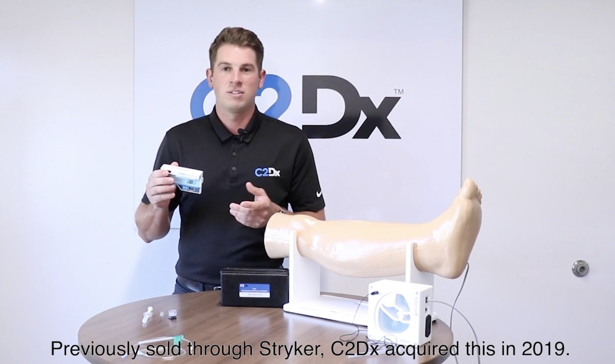 The STIC Intra-Compartmental Pressure Monitor System from C2Dx aids in a timely and accurate diagnosis of #CompartmentSyndrome. See how easy it is to use!

Watch more product videos and patient stories here: bit.ly/C2DxVideos