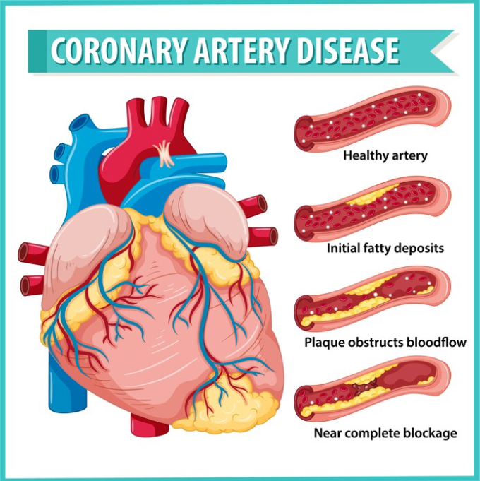 ESSAYFOR_ALL's tweet photo. Acute Coronary Syndrome Homework Help: Essay For All
Visit for more: https://t.co/P9PIoES1zj
#essayforall #assignmentwritinghelp #assignmenthelp #nursingassignment #MedicalHomework #nursingassignmentshelp #nursingstudenthelp #helpwithassignment #nursingcourseworkhelp https://t.co/4SVcbbWmiN