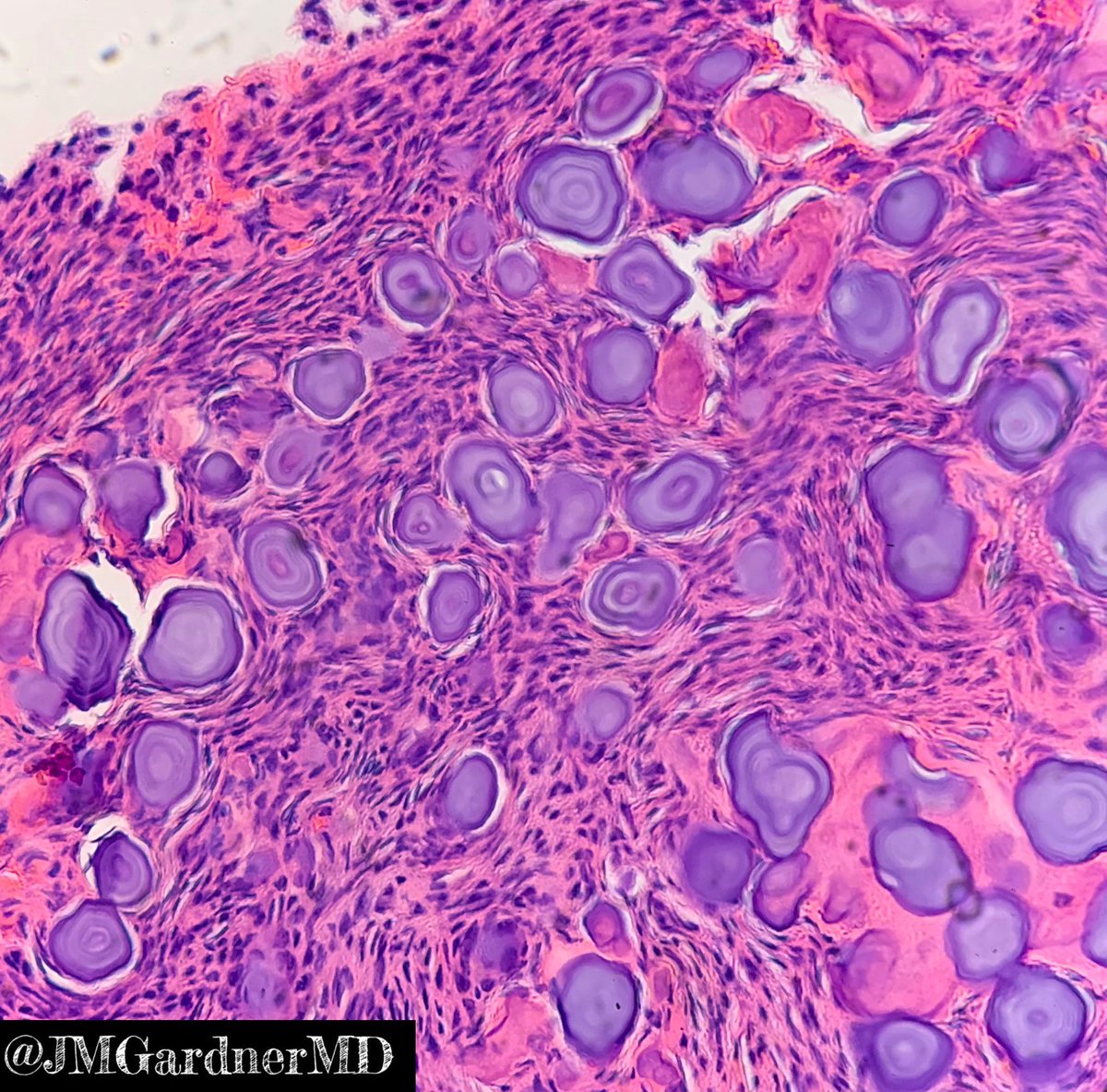 Jerad Gardner, MD tweet media