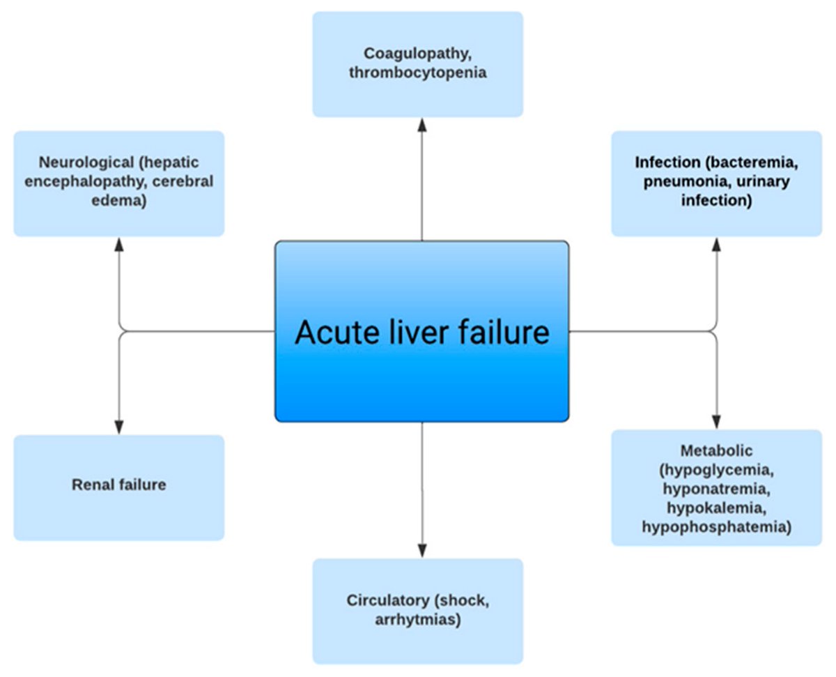 #mdpijcm 🔥 @altmetric High-scoring paper: 'A Comprehensive Review of the Diagnosis and Management of Acute Liver Failure' by @NBegumOzturkMD et al. 👉Read more: mdpi.com/2584224 #liver #hepatitis #transplantation #IntensiveCare