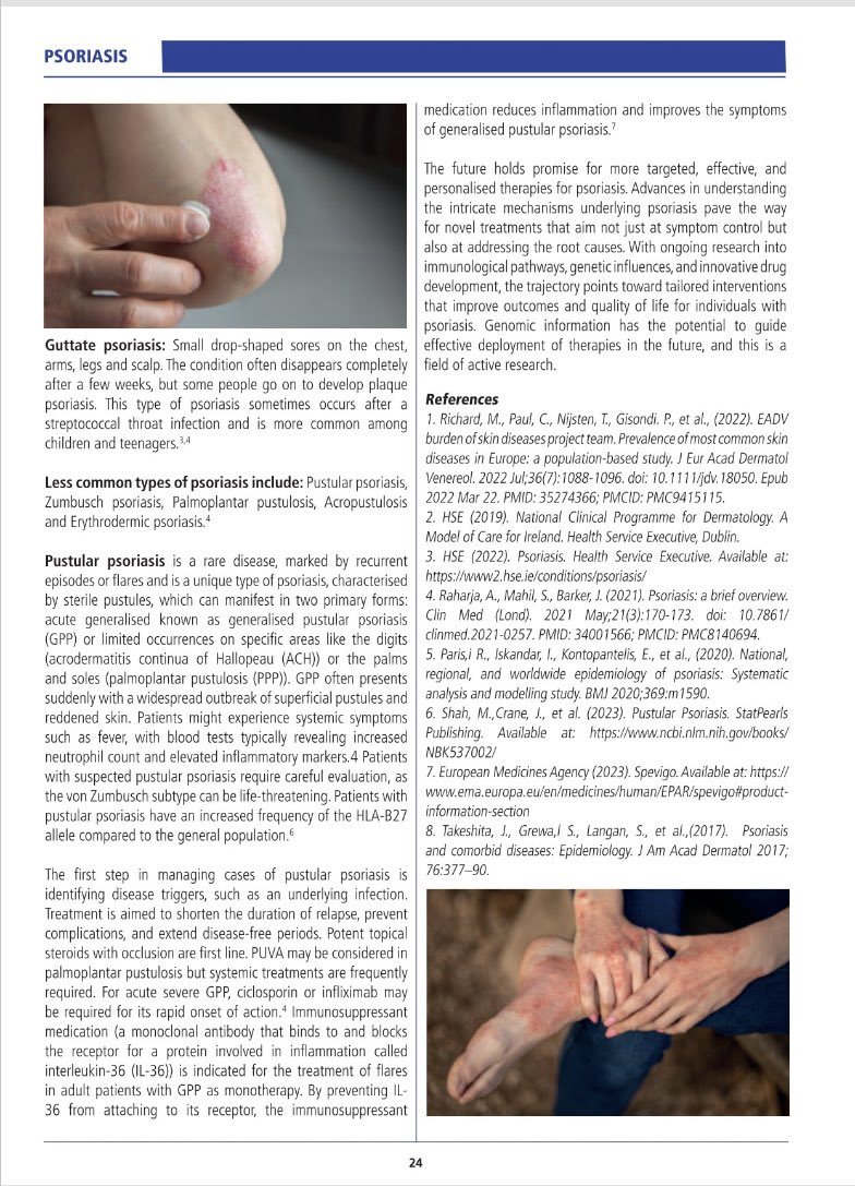 lehnent's tweet image. ‘Overview of #Psoriasis and its Treatment’. Read about #Psoriasis in my article published in #MIMS 2024 Compendium of the year. @IMT_latest. Available at: edition.pagesuite-professional.co.uk/html5/reader/p…