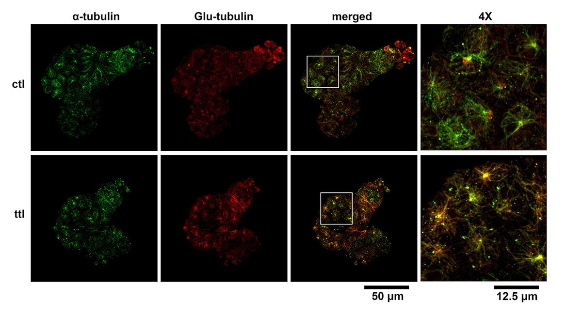 Chiang et al found a recent #GWAS identified a novel locus within #MAPRE2 with encodes #EBP2, implicating microtubule involvement in Brugada syndrome. Learn about a novel therapeutic avenue at ahajrnls.org/47zhcSG 

<a href="/calum_og/">Calum MacRae</a> <a href="/pwburridge/">Paul Burridge</a> <a href="/KiviniemiTuoski/">Tuomas Kiviniemi</a> @disheetshah