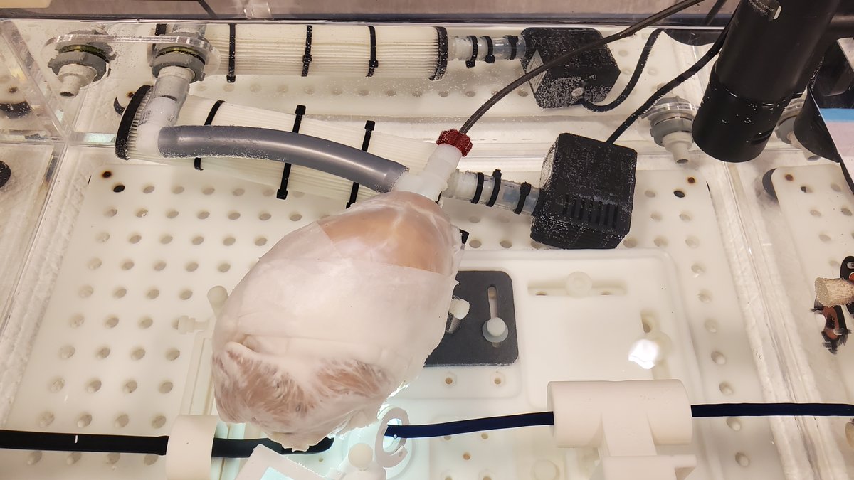 Ascension Borgess Interventional Cardiology (@abh_ic_fellows) on Twitter photo The Borgess Structural Team had a great time yesterday at the Edwards Pascal Precision Physician Training Course!
<a href="/drvishalg/">Dr Vishal Gupta, MBBS, MPH, FACC, FSCAI</a>
<a href="/jagskalavakunta/">Jagadeesh Kalavakunta MD, FACC, FSCAI</a>
<a href="/Abi_sood/">Abhinav Sood</a>
<a href="/EdwardsLifesci/">Edwards Lifesciences</a> The Borgess Structural Team had a great time yesterday at the Edwards Pascal Precision Physician Training Course!
<a href="/drvishalg/">Dr Vishal Gupta, MBBS, MPH, FACC, FSCAI</a>
<a href="/jagskalavakunta/">Jagadeesh Kalavakunta MD, FACC, FSCAI</a>
<a href="/Abi_sood/">Abhinav Sood</a>
<a href="/EdwardsLifesci/">Edwards Lifesciences</a>