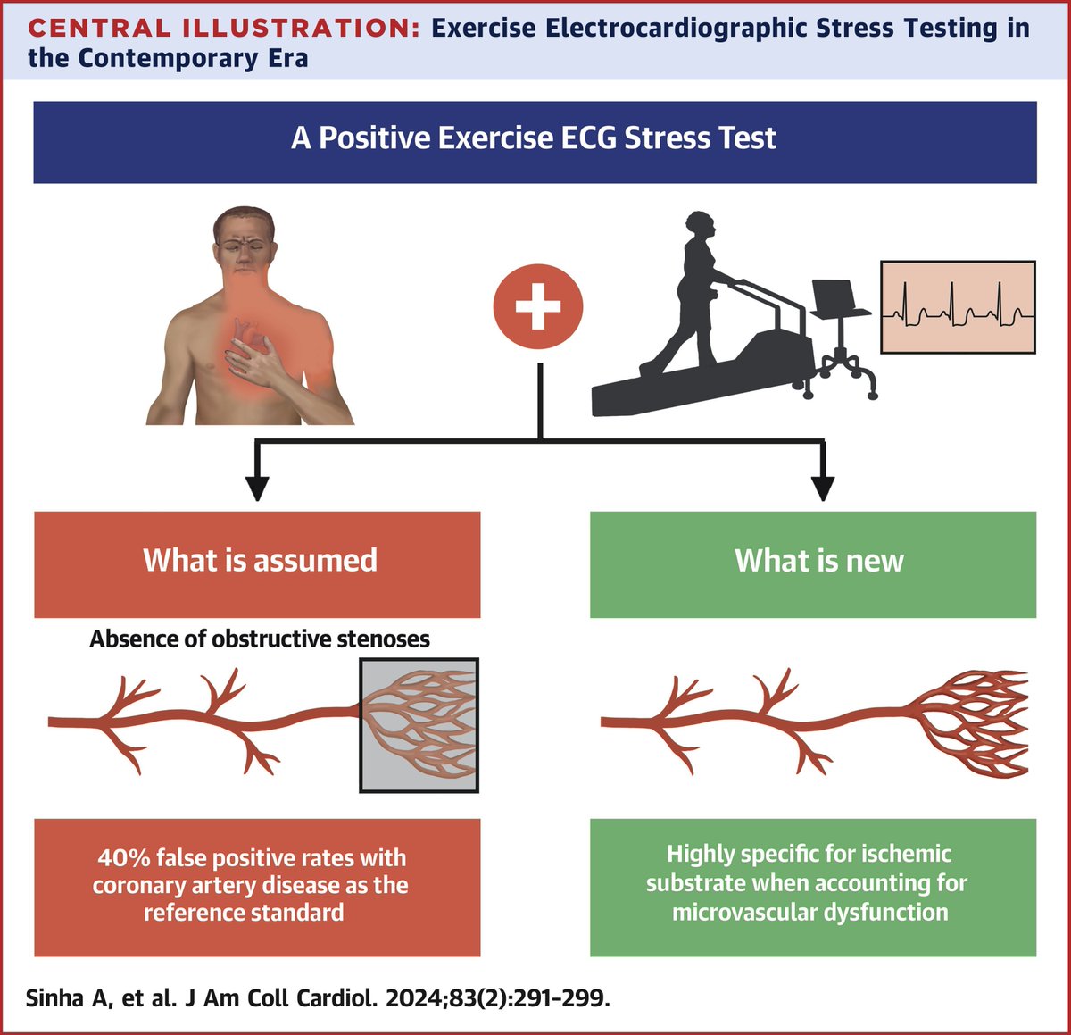 In patients with #ANOCA, ischemia during exercise #ECG stress testing was highly specific for coronary microvascular dysfunction bit.ly/41TKydp #JACC @AishSinha1 @DrHaseebRahman1 @divaka_perera @UKheartresearch