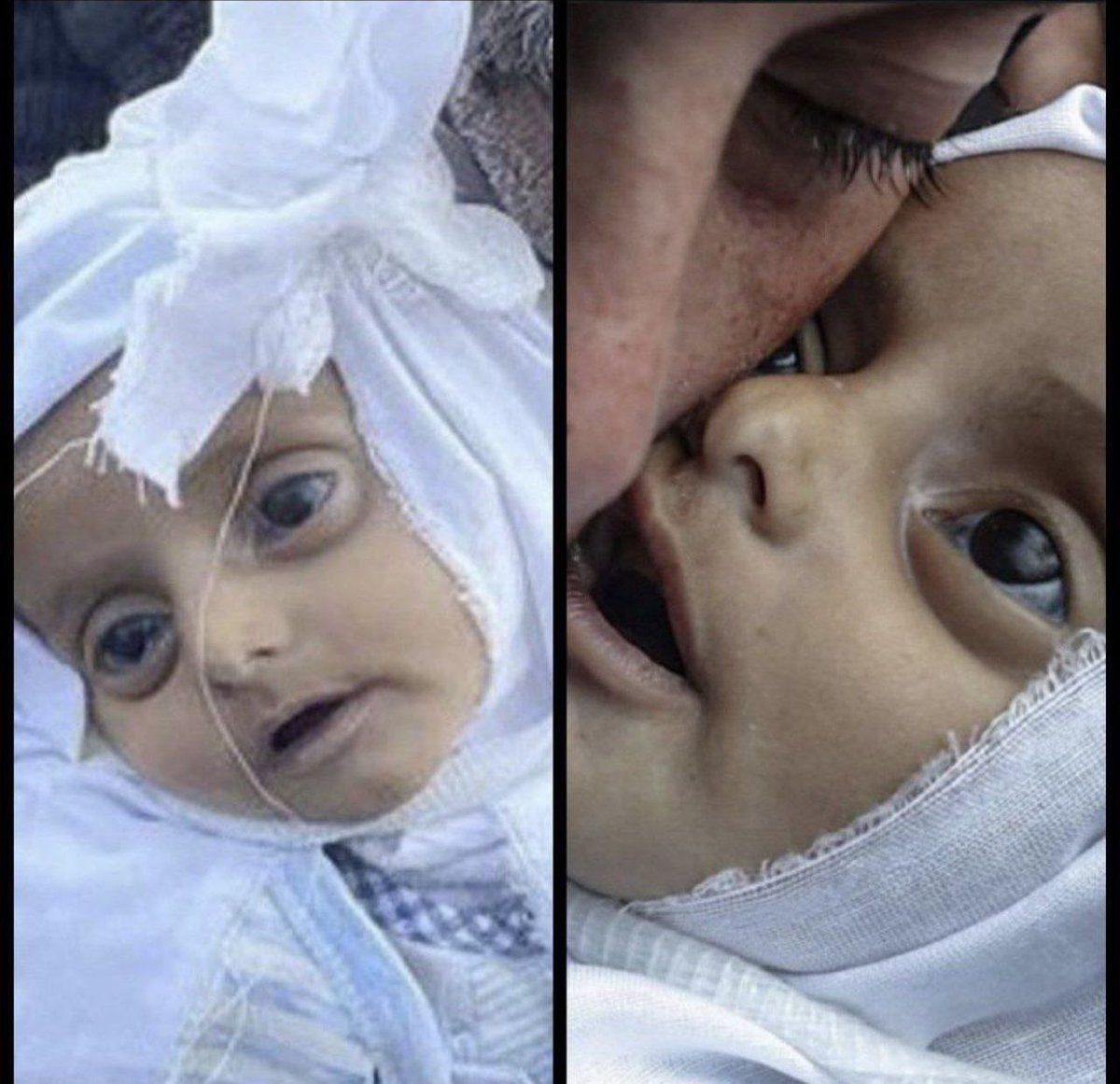AlkhmisF's tweet photo. @CIJ_ICJ @UNWebTV This infant, with bulging eyes, died solely to the horrifying blast's deafening sound, without any physical injuries.
#GazaGenocide
#GenocideinPalestine https://t.co/VxLwFqtQc9