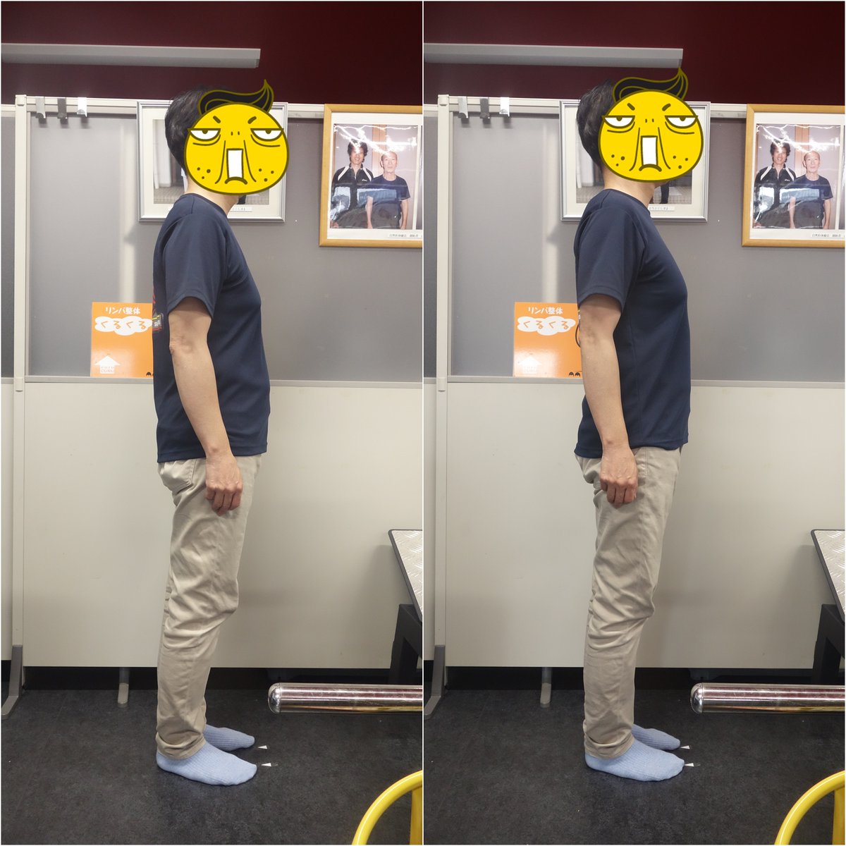 ひろくん777
<a href="/PNCRUSE/">ひろくん777</a> 
さんが姿勢矯正でご来院。
勿論その場でのビフォーアフター写真です。
足が伸び、胸板が分厚く変化、更に男前になられました。