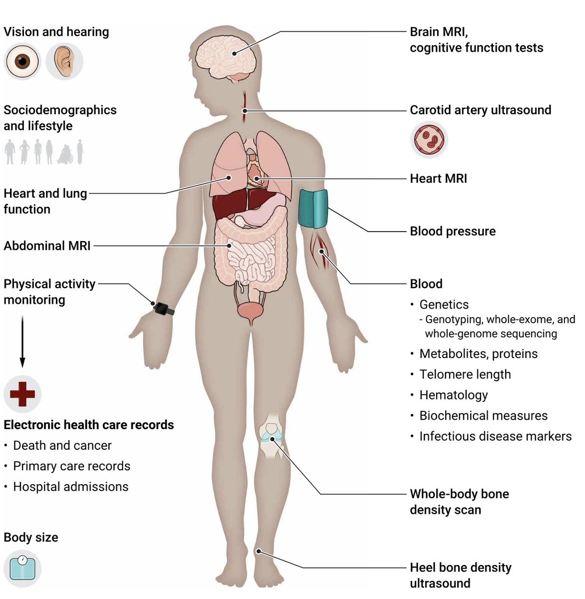The contributions of the @UK_biobank to advance medicine have been profound. Here's a review article that summarizes the data accrued, their exceptional work, and parallel prospective efforts
science.org/doi/epdf/10.11… <a href="/ScienceTM/">Science Translational Medicine</a>