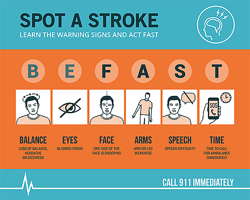 Know the signs of a stroke so you can spot one and call 911 for help when minutes count.