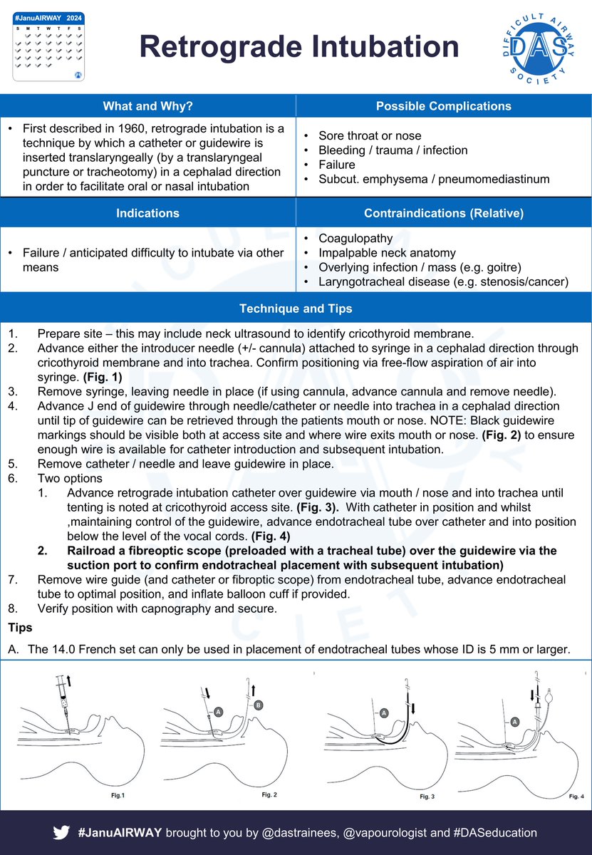 #JanuAirway Day 11. Retrograde Intubation.  This is a useful skill, but one most anaesthetists won’t experience. Let’s start with a #OnePager looking the what, why and how … and what can go wrong.  We’d love to hear about your experiences!
1/5