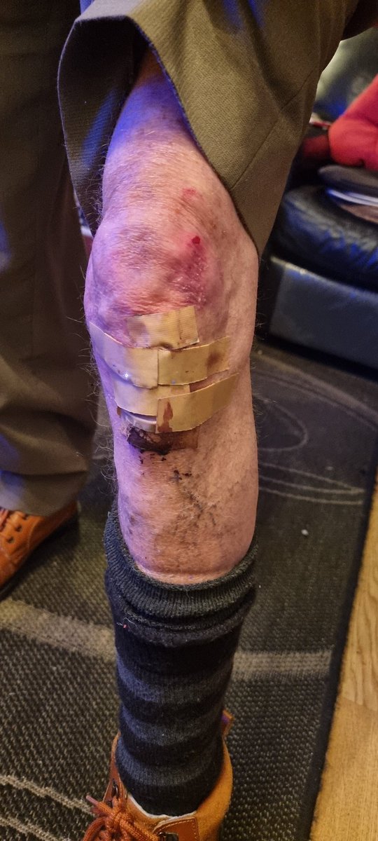 Annoyed at the condition of some of the pavements in Cardiff.
My father today went down due to eneveness of the old paving slabs.
This is the 3rd time it has happened in as many years.
Anyone else in Grange done this?
<a href="/cardiffcouncil/">Cardiff Council</a> <a href="/GrangeCitizens/">Grangetown Citizens</a> <a href="/GrangetownHub/">GrangetownHub</a> <a href="/grangecardiff/">Grangetown community</a>