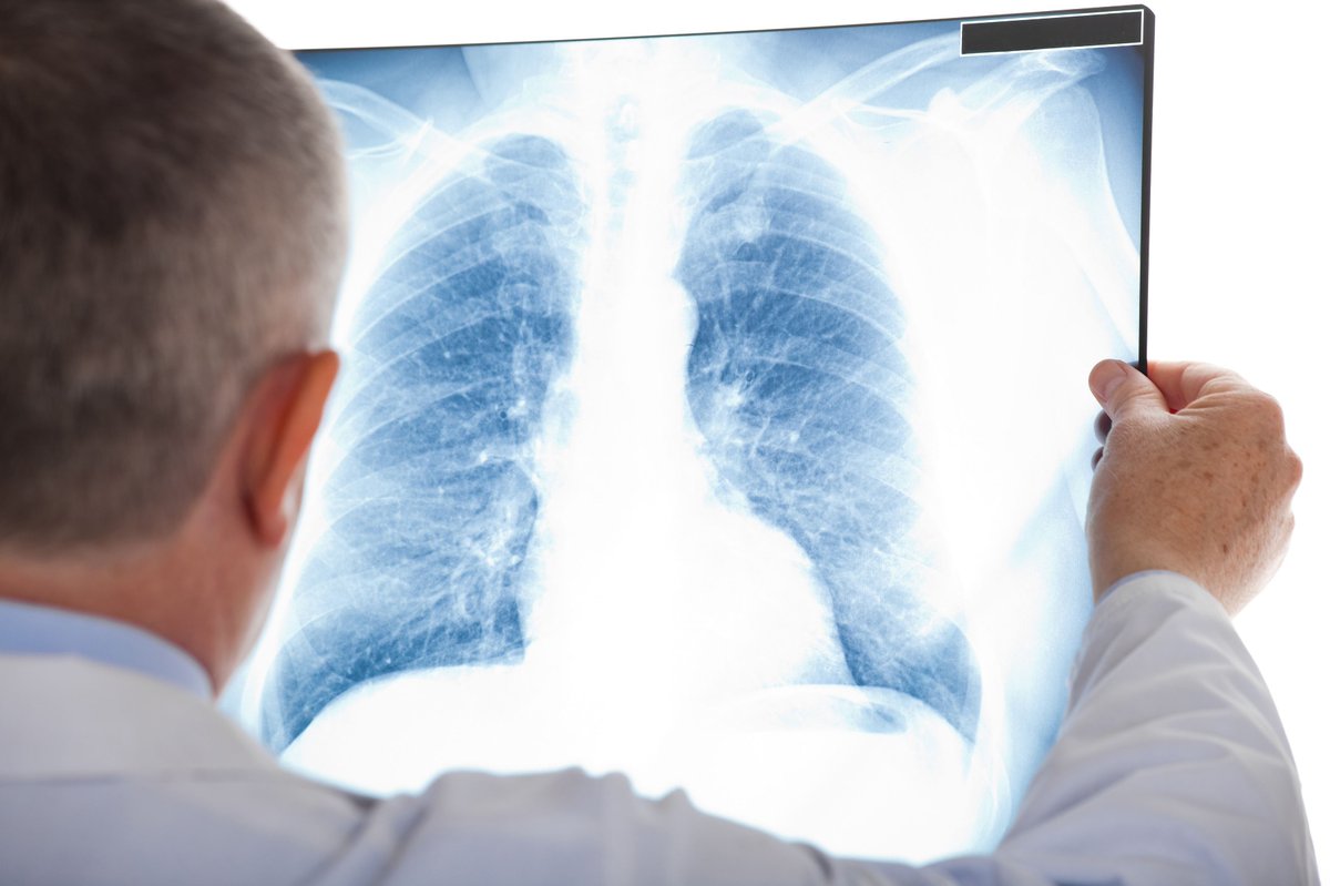 Wales ranks among world's worst for survival rates from deadliest cancers tinyurl.com/yzvx7d8m