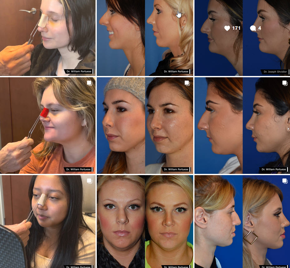 The Portland Center for Facial Plastic Surgery tweet media