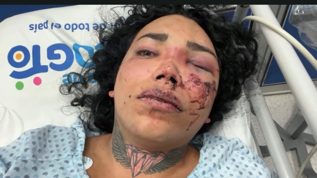 KL Chart 🦂 tweet media