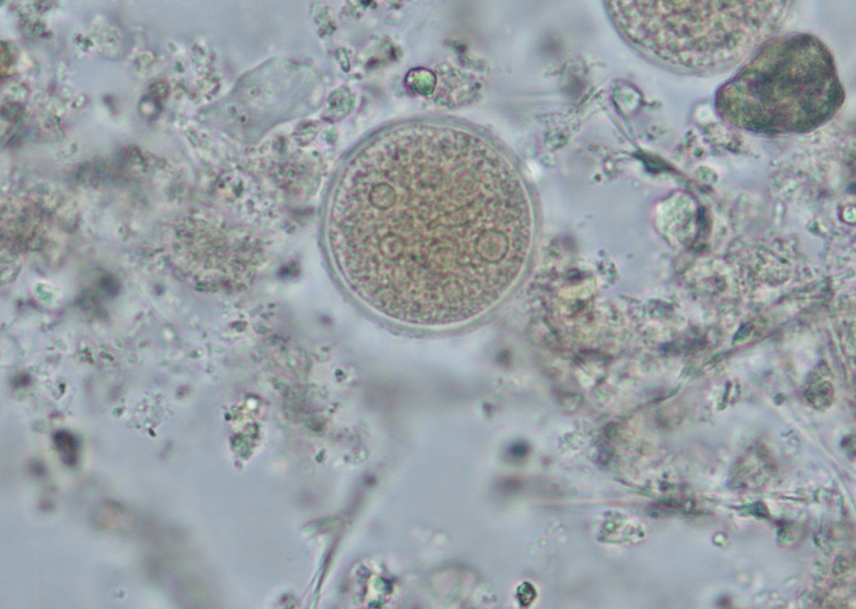 The first #Parasite Case of 2024 is up– Found in a concentrated stool wet prep (~20 µm diameter). parasitewonders.blogspot.com/2024/01/case-o…? #mayopath #pathology #CrittersOnTwitter #PathBugs