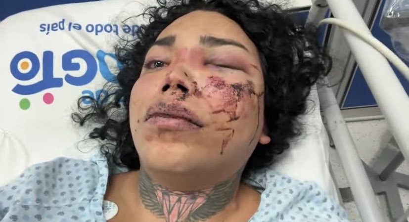 CrofickOficial's tweet photo. 🚨 #ÚltimaHora | #PaolaSuárez, de "Las perdidas", brutalmente golpeada por su novio tras pedirle matrimonio. Actualmente en el Hospital General de León, #Wendy y amigas buscan trasladarla a un hospital privado. Urgente apoyo y difusión. #ViolenciaNo #JusticiaParaPaola https://t.co/FSgnV6EeWH