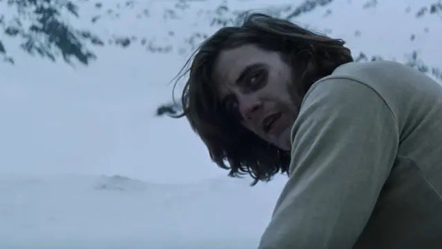 Niños estoy un poco obsesionada con la sociedad de la nieve entonces les traigo dato nerdo médico 🤓👆🏼 si vieron a Nando Parrado en la película con el signo de mapache y que dijeron que estuvo en coma 3 días?