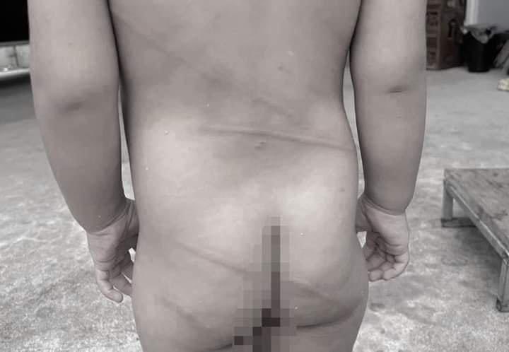 #พ่อแท้ๆทำร้ายลูกตัวเอง อายุ2 ขวบ
แม่เด็กขอความช่วยเหลือ ร้องเป็นหนึ่ง เร่งช่วยเหลือลูกชายวัย 2 ขวบ ถูกอดีตสามีของตนซึ่งเป็นพ่อแท้ๆของลูก 
#ทำร้ายร่างกายลูกเพื่อประชดตน !!!

หญิงสาวรายหนึ่งได้ร้องทางเป็นหนึ่ง