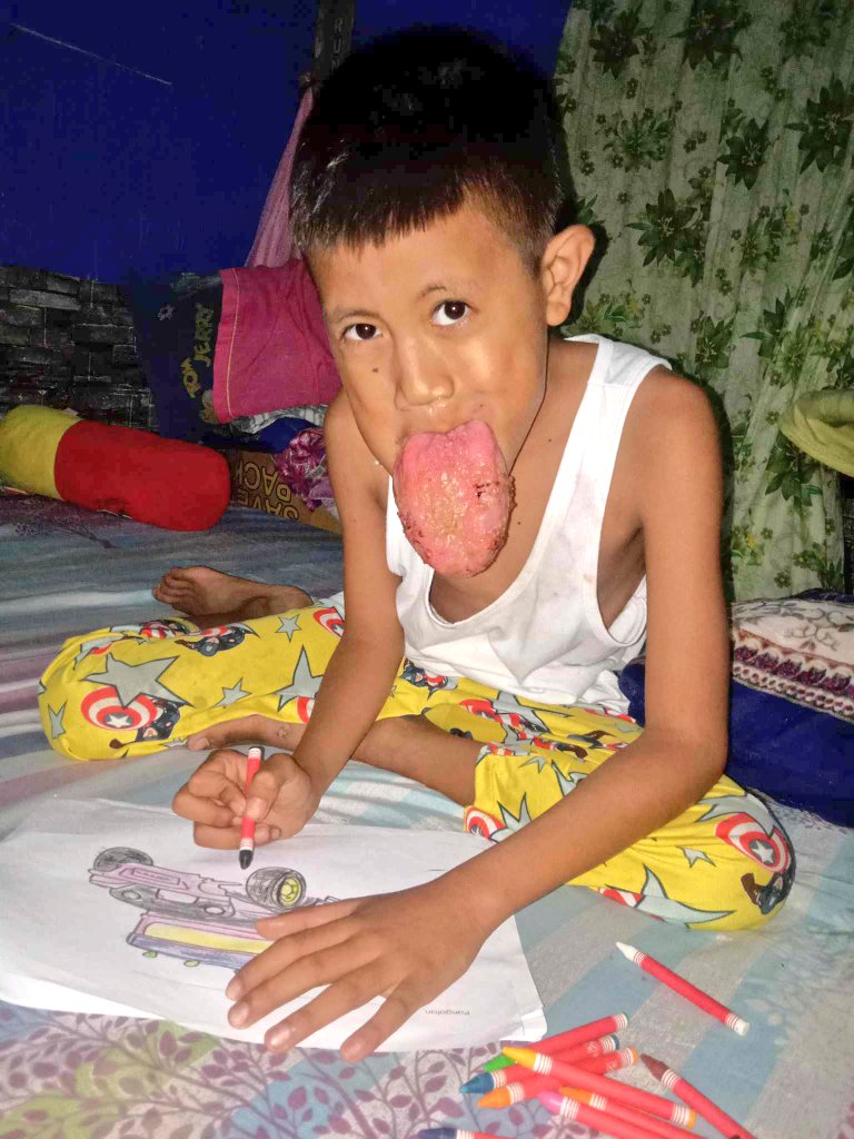 It takes 0 second to repost this tweet. Please help our group provide for sick children. Please help us raise ₱14,700 ($290) for Leonardo, he is diagnosed with hemangioma. He underwent series of chemotherapy, however it didn't work well. He is currently under oral medication