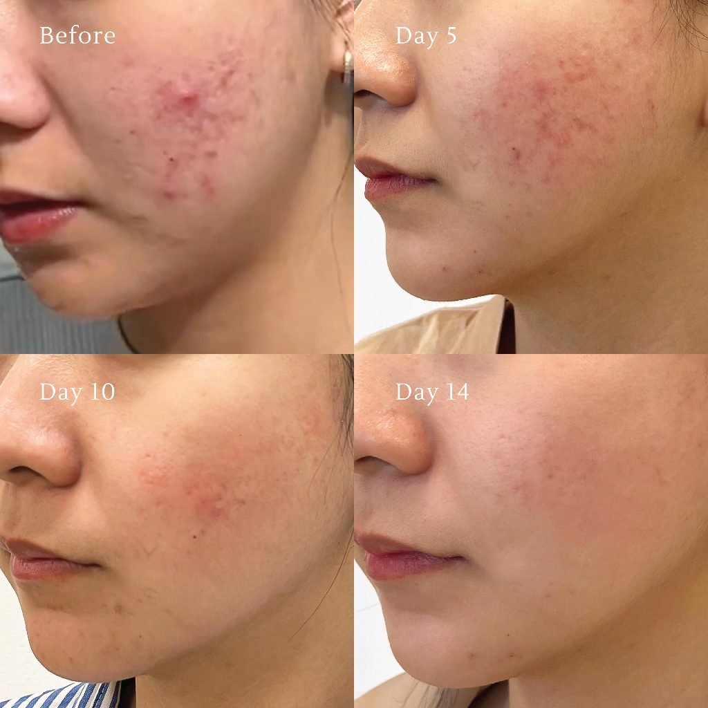 cesize's tweet photo. DIJAMIN KULIT TENANG ABIS PAKE INI ¡! ❞

rekomendasi skincare (JELLY MASK VER.)
— a thread

#skincare #skincareroutine #jellymask #racuninskincare #racunbelanja #racunshopee #Shopee https://t.co/EDJHH0nqiH