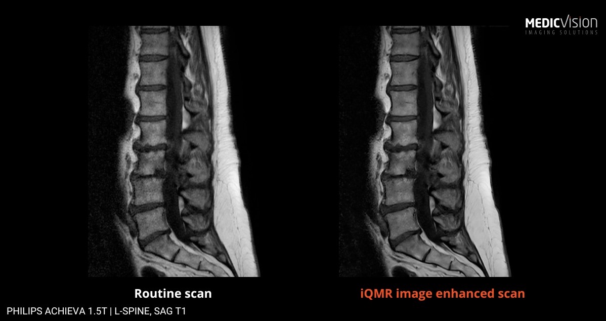 Medic Vision Imaging Solutions tweet media