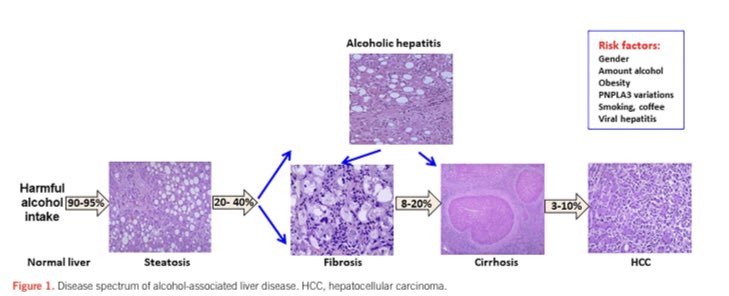 GIJWatch_Africa's tweet photo. ACG Clinical Guideline: Alcohol-Associated Liver Disease : Official journal of the American College of Gastroenterology | ACG 

https://t.co/wLSknZYdd5 https://t.co/gfwgjmUyKn