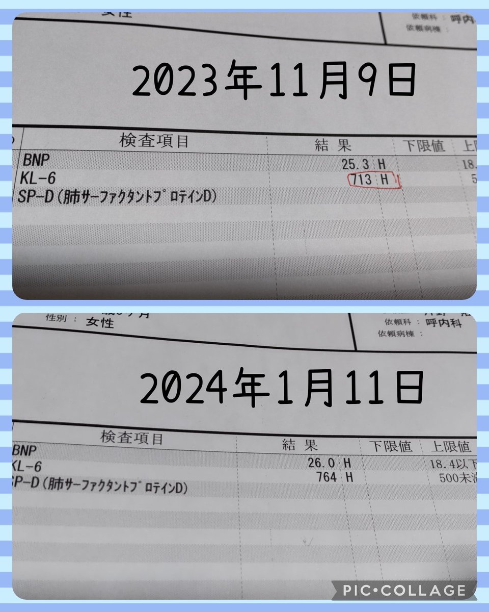 RiePokegoTL45's tweet photo. 今日は🏥大学病院で定期診察の日でした。
肺の数値(KL-6)が前回(2023年11月9日)は713でしたが、今日は764でした。
横ばいの数値だったので安心しました。
#全身性強皮症 
#間質性肺炎
#KL6 https://t.co/jGWEU6WY0j