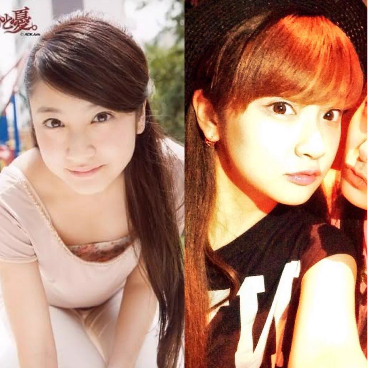 小澤美里整形