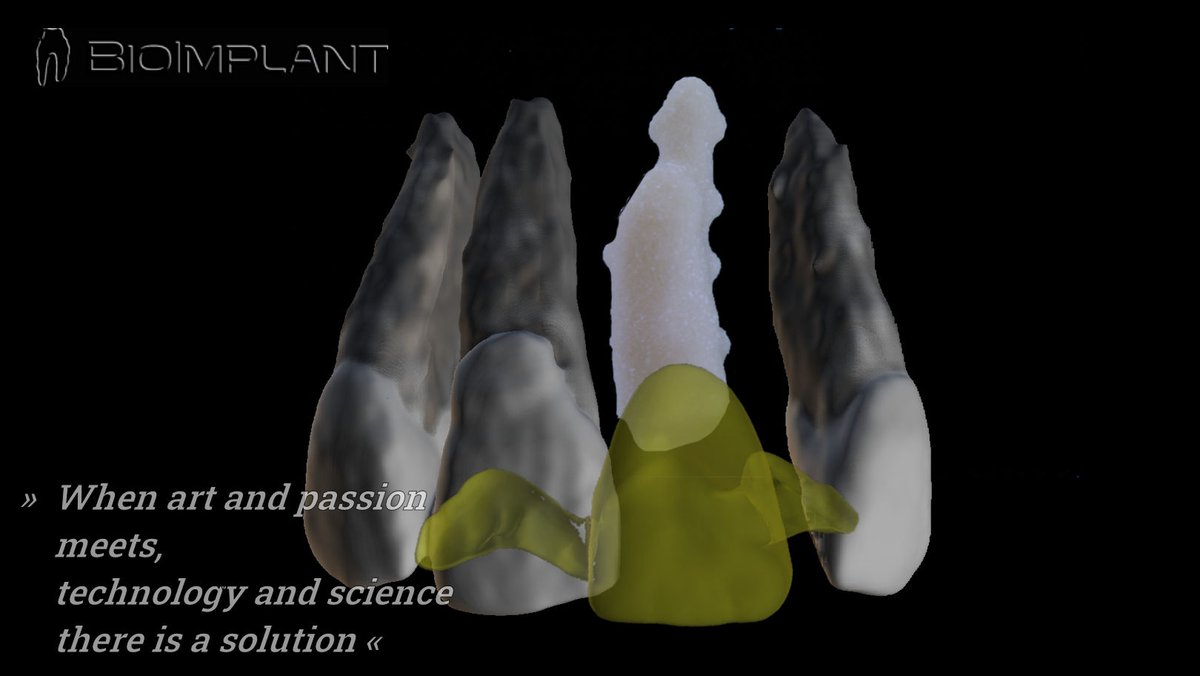 BioImplant (@bioimplant) on Twitter photo 