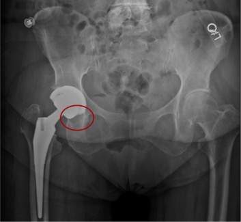 Arthroplasty Today tweet media