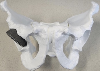 Arthroplasty Today tweet media