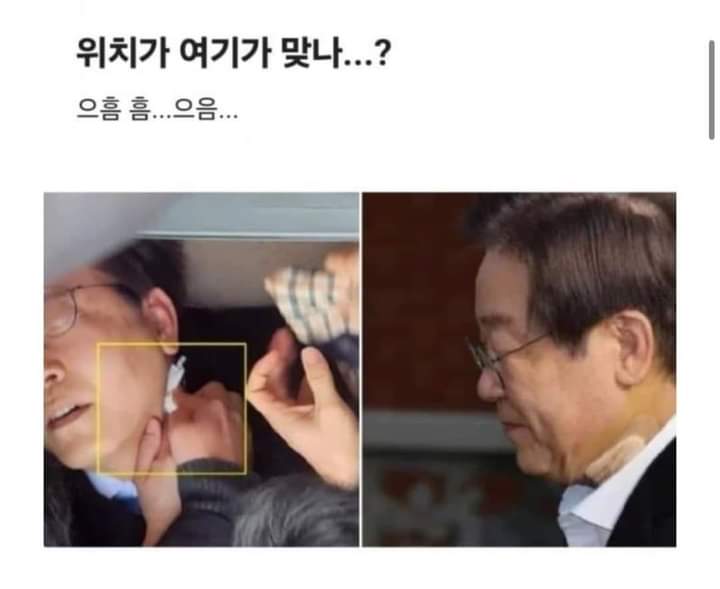 서울대병원은 반창고도 제대로 못 붙이나?