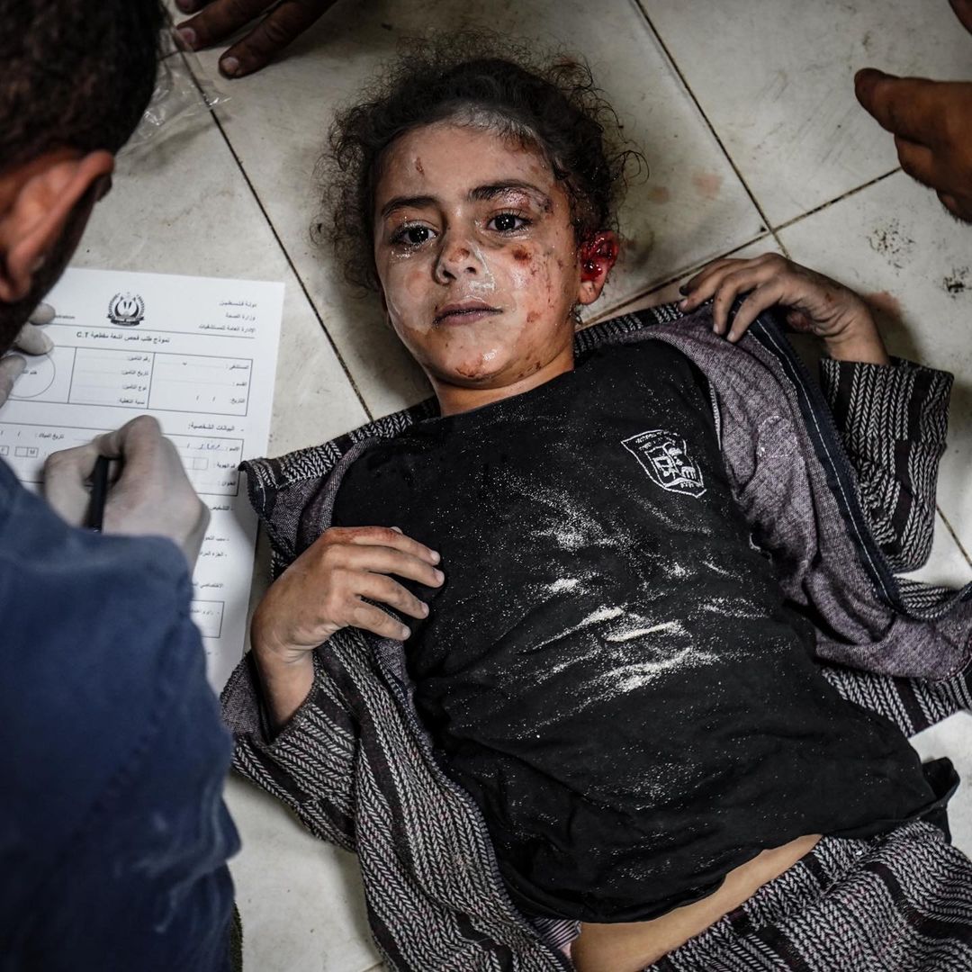 haider_mossawy's tweet photo. A number of injuries and martyrs among children and women after bombing homes and shooting from drones at citizens in their homes in the city of Khan Yunis, south of Gaza.
Photo:Belal Khaled https://t.co/aGwEntpWwJ