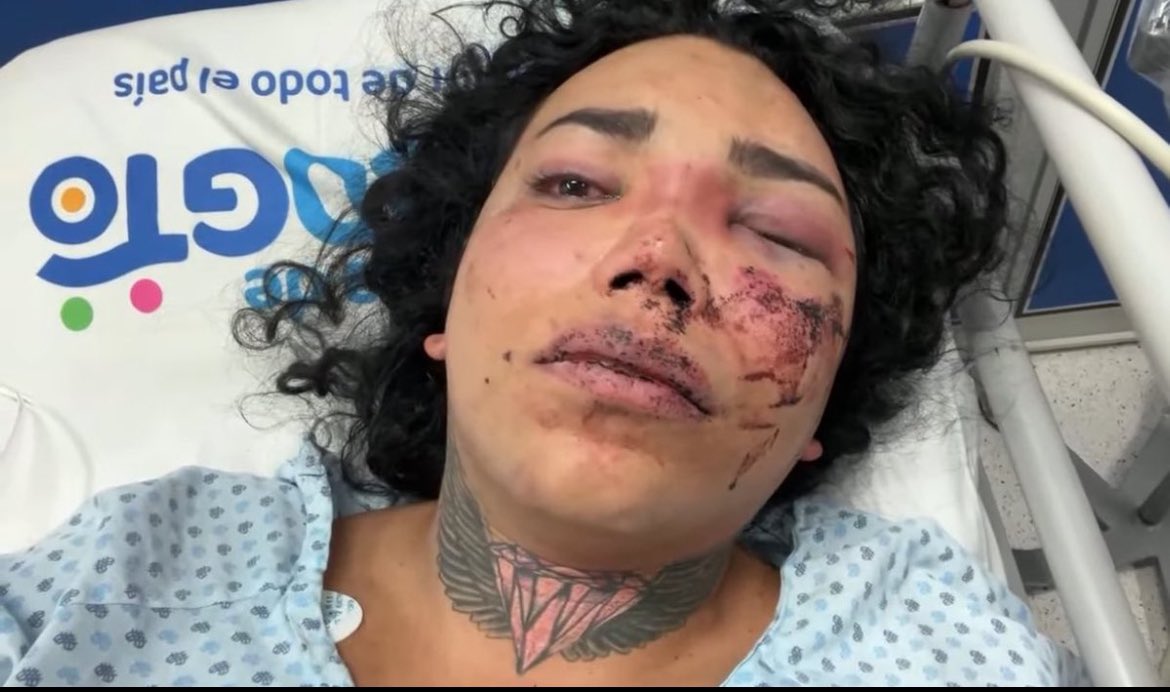 yael_kos's tweet photo. Siempre veo sus videos cuando estoy aburrido o triste, Paolita siempre me saca una sonrisa, ni ella ni nadie merece ser maltratado espero el culpable pague por todo lo que le hizo y que Paola se recupere pronto. 🤍

JUSTICIA PARA PAOLA SUÁREZ https://t.co/XwOyTU5kG0