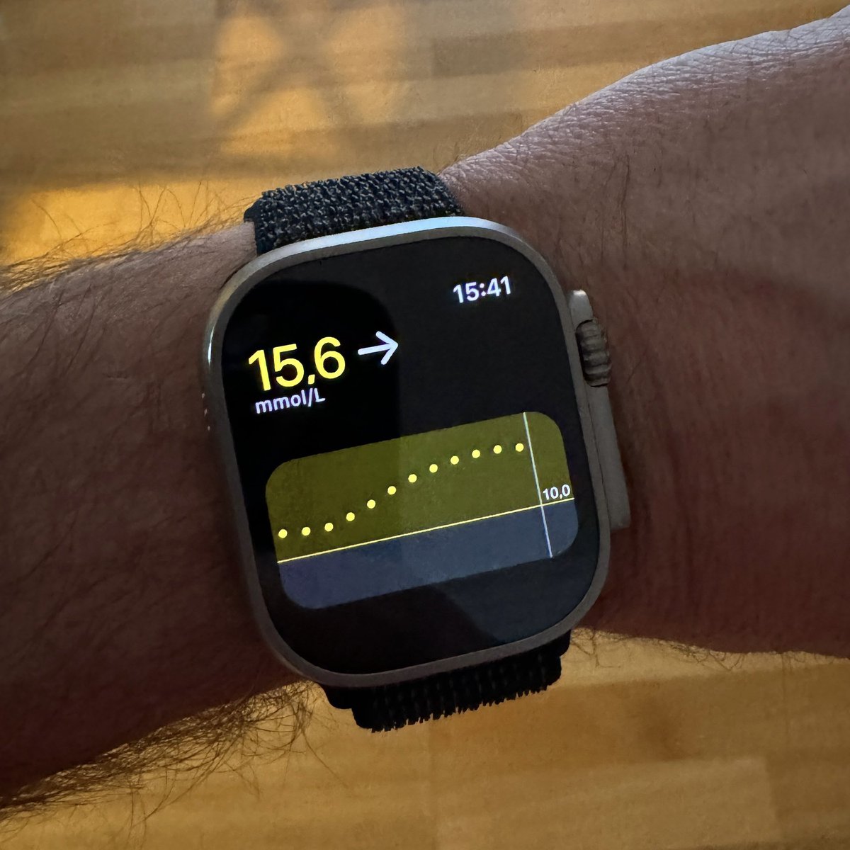 TeknikPappa's tweet photo. Hey @dexcom!
Time to update the Follow app and make it fully compatible with Apple Watch Ultra. As for now it cuts the graph very ugly and 1/3 of the graph doesn’t show. Should be an easy fix! https://t.co/SC0Fym1Pod