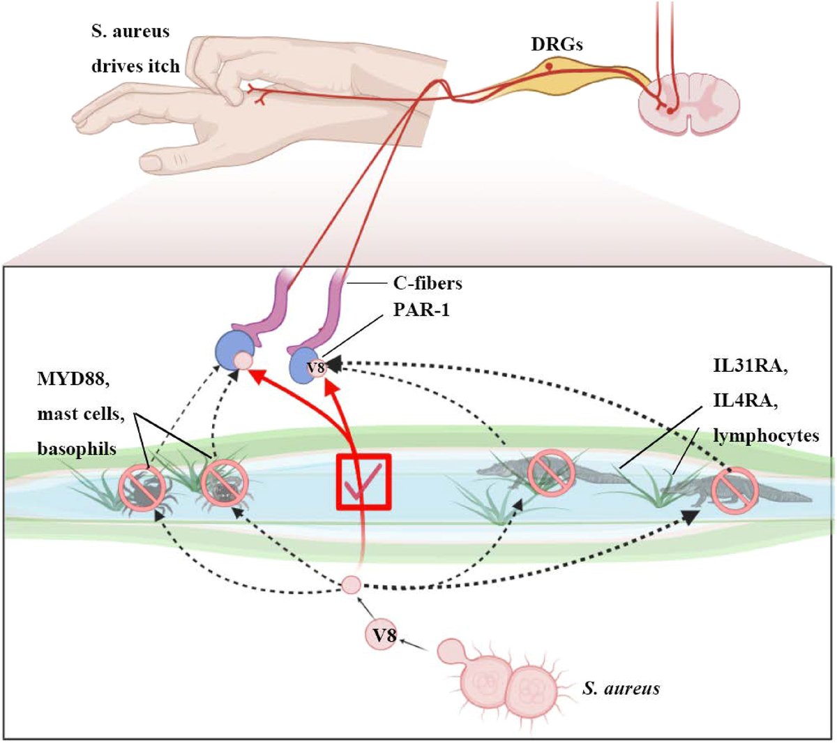 Better than being aPARt: S. aureus itches to get close to sensory neurons. Highlight of work by <a href="/Liwen_Deng811/">Liwen Deng</a> <a href="/IsaacChiuLab/">Chiu Lab</a> <a href="/CellCellPress/">Cell</a> showing #Saureus protease V8 triggers itch, independent of inflammation, by activating sensory neurons through PAR1 cell.com/cell-host-micr…