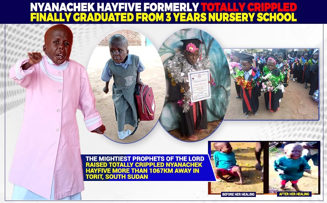 PicotyChelangat's tweet image. India has met The Two Mega Prophets of YAHWEH, and they have witnessed their own healed.

Let us give God glory. 

In picture, Nyanachek from South Sudan. 

She is now walking to school and studying. 

Thank you, Men of God. #HealingService