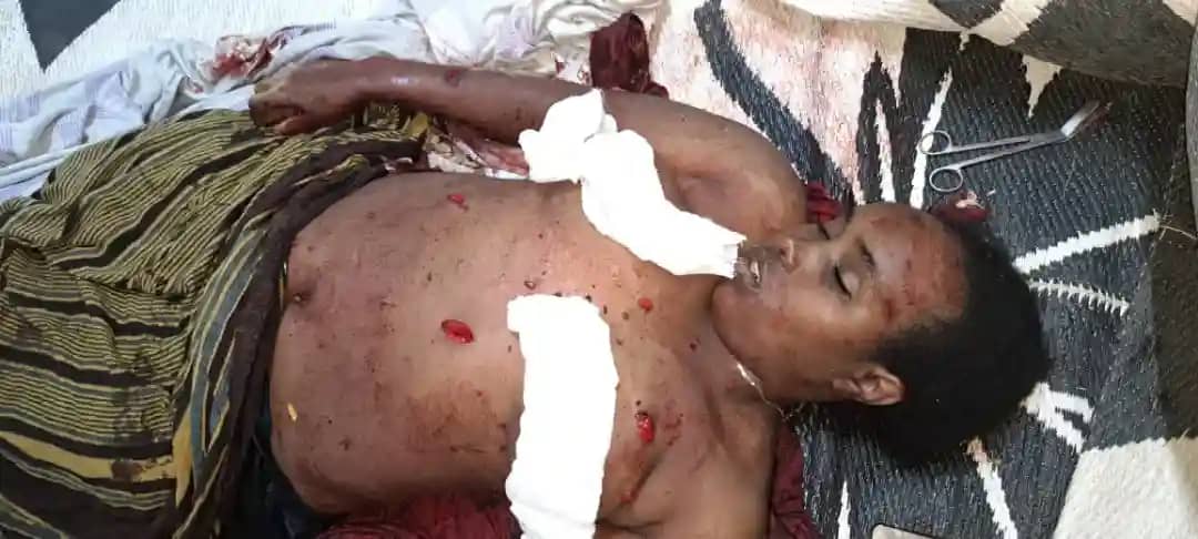 SabaanBon5's tweet photo. Shamarreen Oromoo #Firdoosa_Jamal_aliyii jedhamtuu (Somalia)magaalaa Dhusamareb keessatti guyyaa 10/1/2024 lammii somaleetiin qalamtee, kunis ummata keenya somalia jiru rifaasisee jira reeffii isii Hospitaala Giddugaleessaa magaalaa Dhusamareb geeffamee. Jira https://t.co/pyGoBhWKPQ