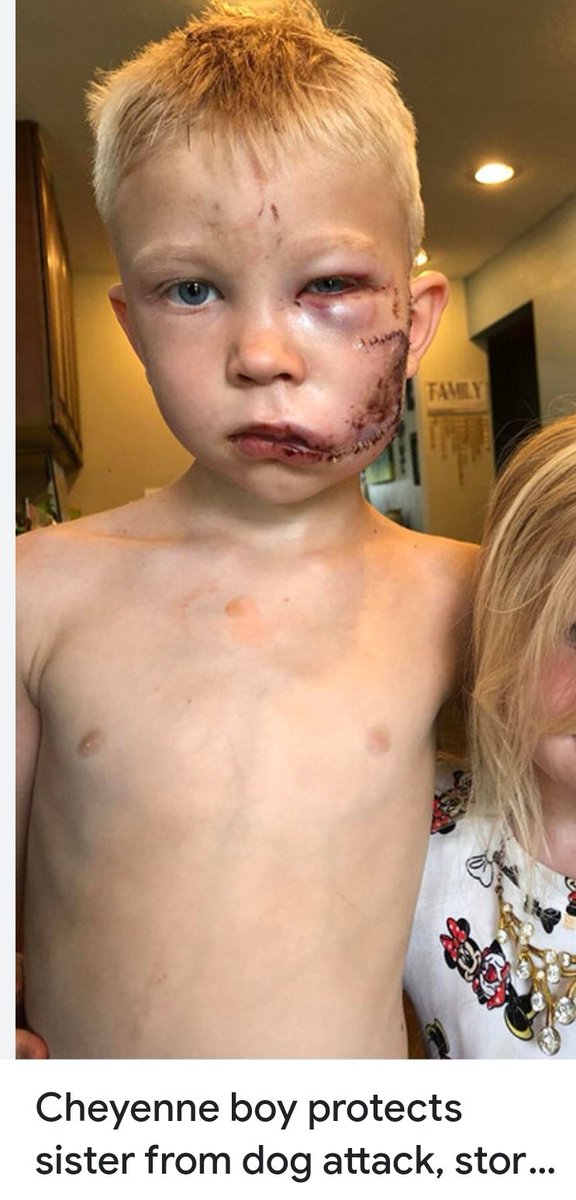 Montbardorcslyr's tweet image. Varför kan ni inte koppla era hundar? Kan ni de lagar &amp;amp; regler ni är ålagda att följa? Varför måste man tjata,säga till er hela tiden? Tror ni att er hund är ett människobarn? Varför tjafsar ni alltid emot utan att ha något på fötterna? 

"-Zorro gillar inte kopplet"

Dra åt...