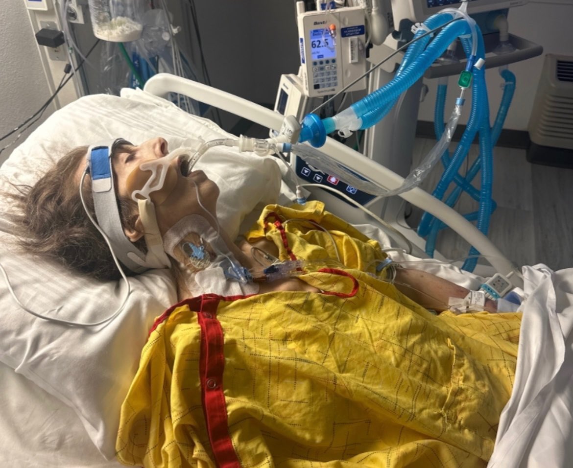 DiedSuddenly_'s tweet photo. Tonja Marie Johnson was an Administrative Assistant for the state of Nevada who was mandated to take the Covid Vaccine. She quickly declined and eventually passed away. 

Prior to passing away she was bedridden & unable to walk due to an “unexplained illness”

Her weight dropped to 70 lbs., her stomach & spleen were removed, she had clots in her legs & lungs, and paralysis. 

She died a horrible death. Heartbreaking.
