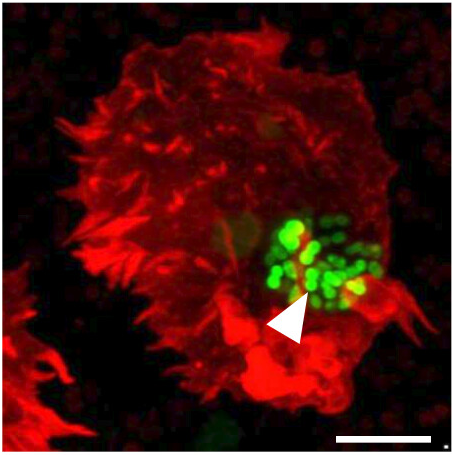 aftabnadeem18's tweet photo. Thrilled to announce our latest paper now published in #MicrobiologySpectrum: “Colony phase variation switch modulates antimicrobial tolerance and biofilm formation in Acinetobacter baumannii”. A fantastic way to kick off the new year! Check it out here:
https://t.co/pkVZCaeNQG https://t.co/WQHEnEEy9B