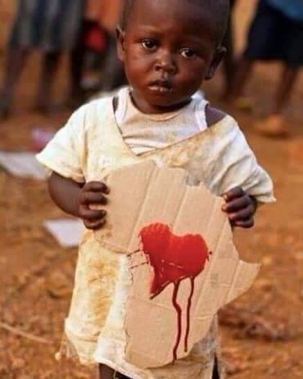 MD_Uzorma's tweet photo. CONGO🇨🇩 IS BLEEDING AND THE WORLD IS SILENT Then CAME PALESTINE

And everybody is concerned about the people and the children being killed. Millions of children have been killed in Congo and are still being killed and nobody cares. https://t.co/FQpcqPCaky