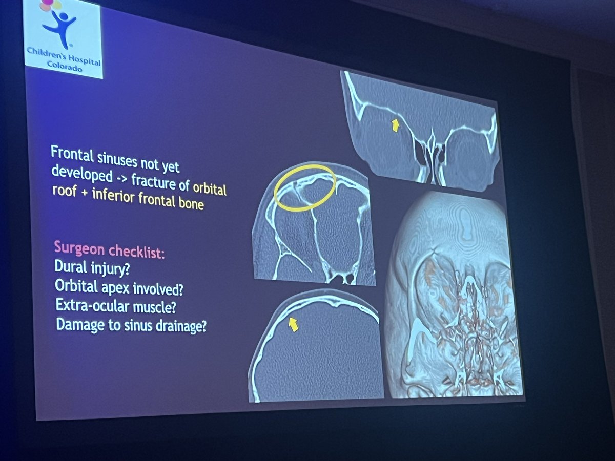 Dr Christina White helping us understand #pediatric facial trauma in the #corecurriculum at #ASPNR24. What does the surgeon need to know? #pedineurorad @HeadNeckRads @ChildrensColo