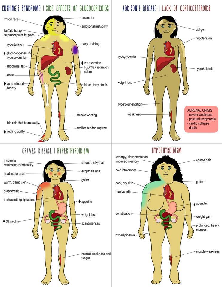 medictests's tweet photo. Cushing's disease, Addison's disease, Graves' disease, and Hypothyroidism https://t.co/osgfj5pgIJ