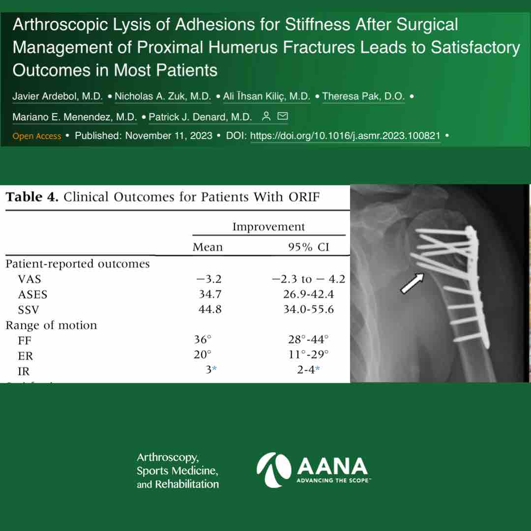 Shoulder arthroscopic lysis of adhesions after prior proximal humerus ORIF yielded 82 % satisfaction and a mean 3.2 point VAS reduction with ROM gains of 36 FF and 20 ER. @PatrickDenardMD ow.ly/2rJM50Qovy6