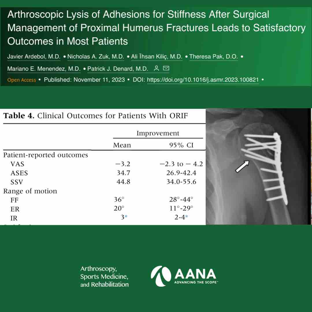 Arthroscopy Journal (@arthroscopyj) on Twitter photo Shoulder arthroscopic lysis of adhesions after prior proximal humerus ORIF yielded 82 % satisfaction and a mean 3.2 point VAS reduction with ROM gains of 36 FF and 20 ER.
<a href="/PatrickDenardMD/">Patrick Denard, M.D</a>
ow.ly/2rJM50Qovy6 Shoulder arthroscopic lysis of adhesions after prior proximal humerus ORIF yielded 82 % satisfaction and a mean 3.2 point VAS reduction with ROM gains of 36 FF and 20 ER.
<a href="/PatrickDenardMD/">Patrick Denard, M.D</a>
ow.ly/2rJM50Qovy6