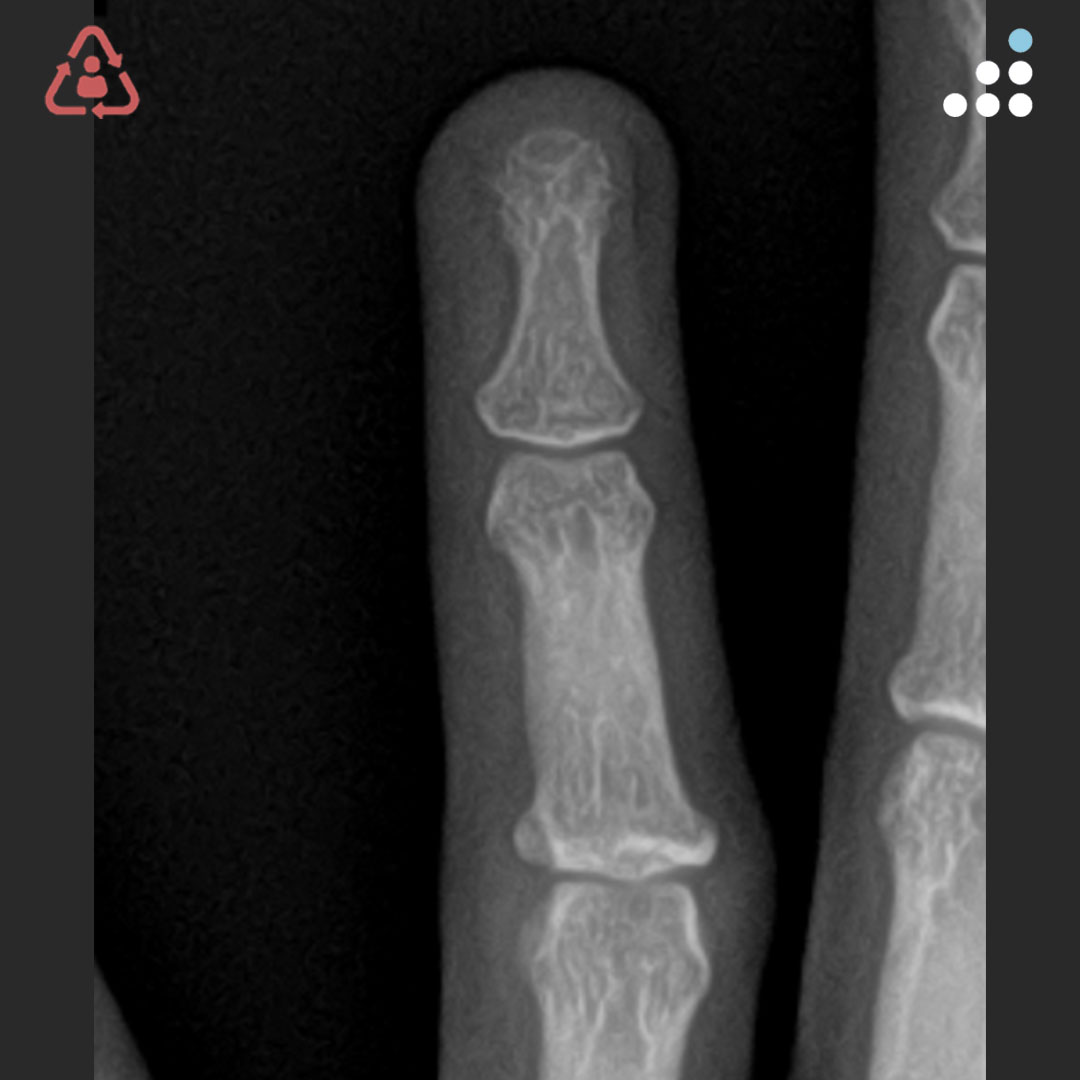 Orthobullets tweet media