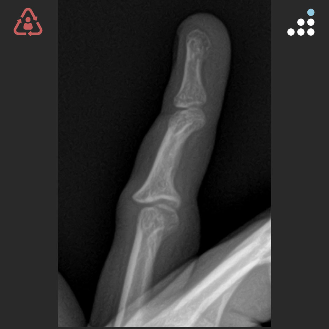 Orthobullets tweet media