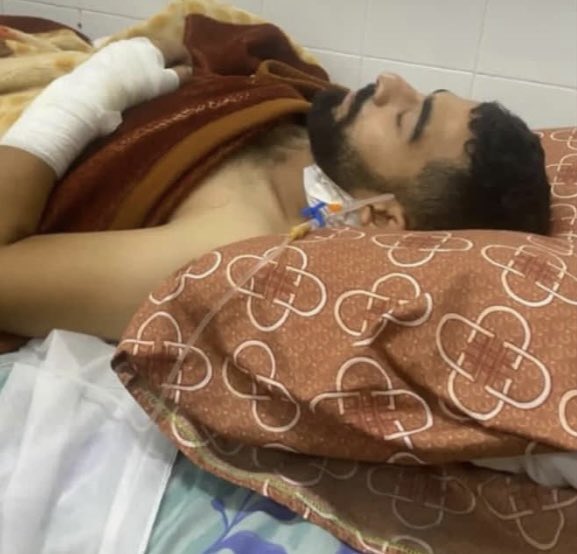 Aywa_anaBen0a's tweet photo. ياريت تعملوا شير يا شباب وتشاركوا في الهاشتاج ده لعل وعسى نقدر نساعد

أحمد شغال في تعبئة المياة لمدارس الوكالة و البيوت و النازحين تم استهدافه هو ومن معه بشكل مباشر ، أحمد فيه كسر بالجمجمة محتاج يطلع ويتعالج هو المعيل الوحيد لعائلته و أب لثلاث أطفال ، محتاج عملية عشان يقف على رجليه وما يفقد بصره نناشد بمساعدة لأحمد يطلع برا غزة يتعالج #انقذوا_أحمد_أبوكرش